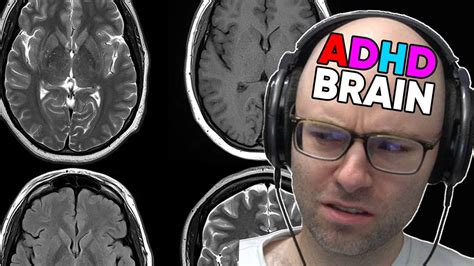 youtube adhd videos|adult adhd youtube.